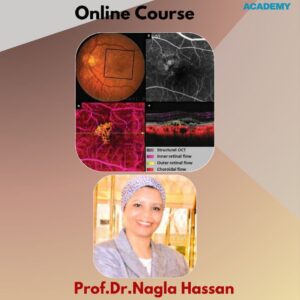OCT Angio Online Course